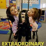 連體雙胞胎 第一季